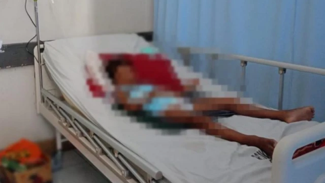 Siswa SD Korban Perundungan Dirawat di RSUD dr R Soedjono Selong